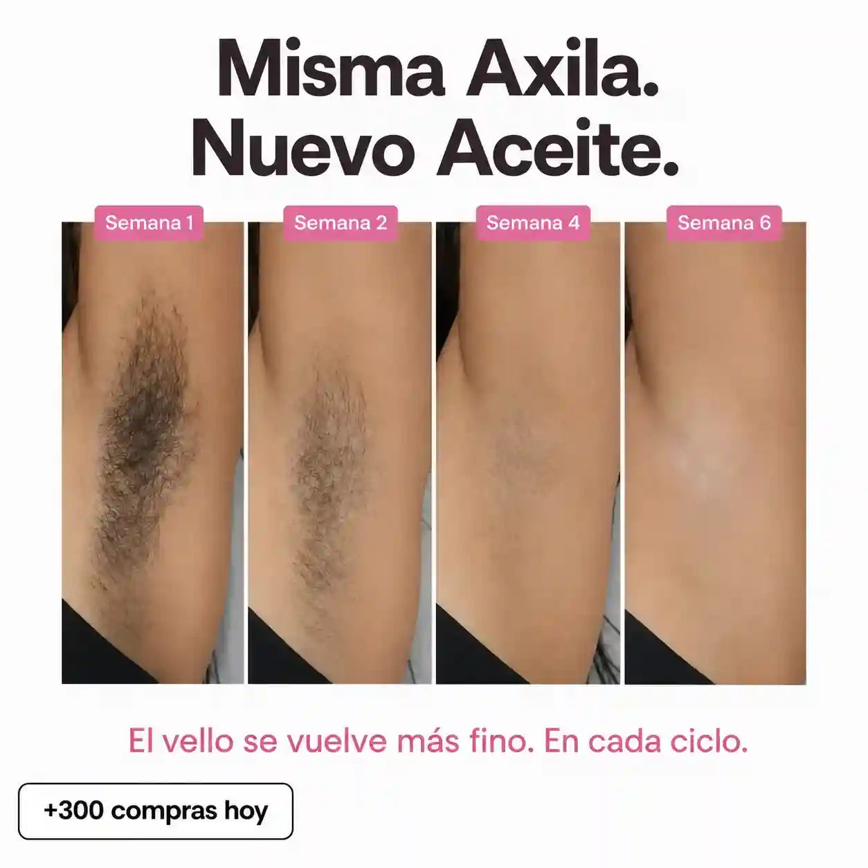 Aceite Anti-Vello