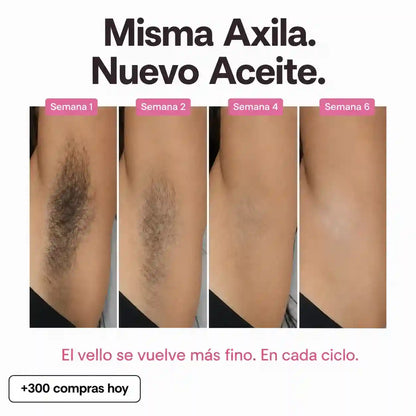 Aceite Anti-Vello