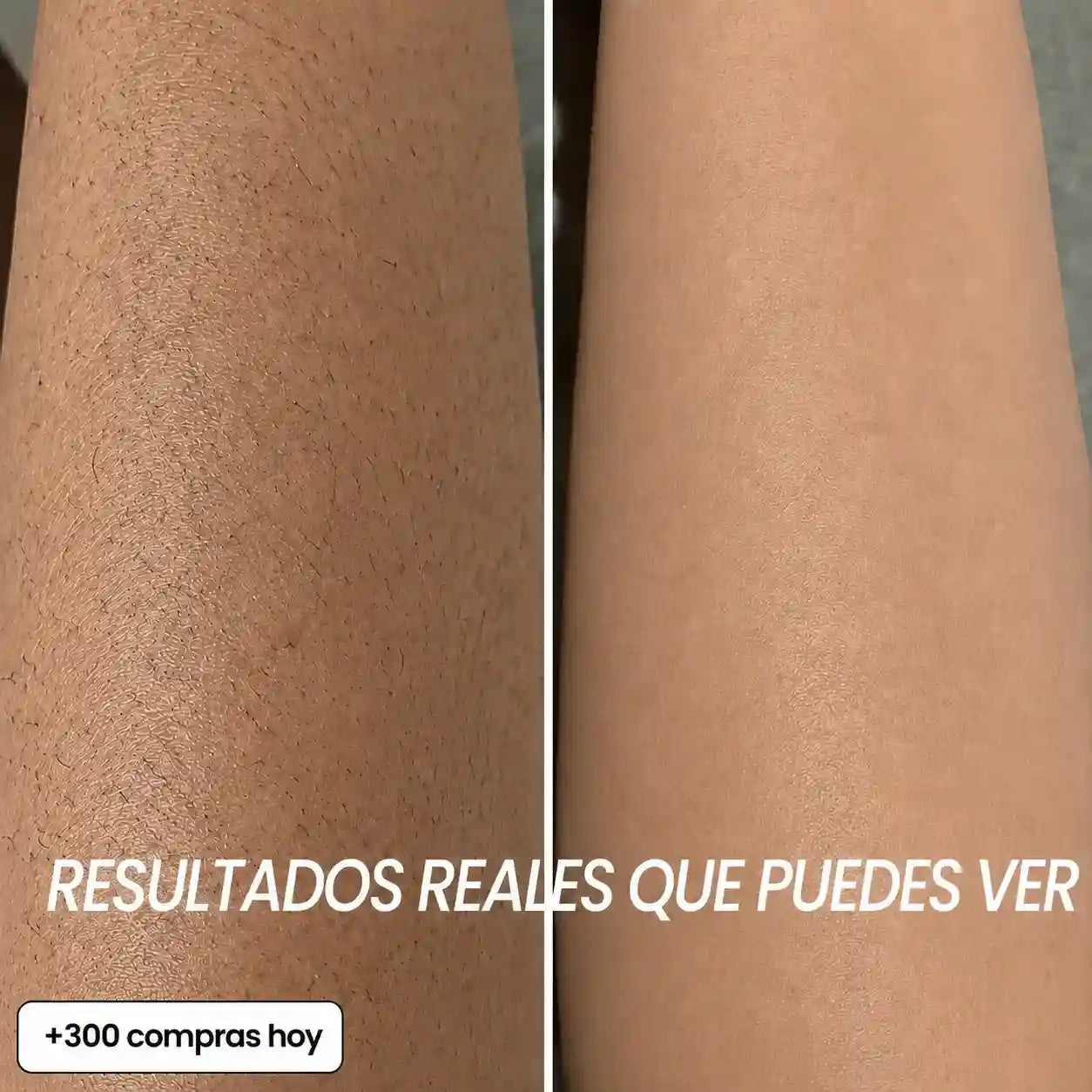 Aceite Anti-Vello