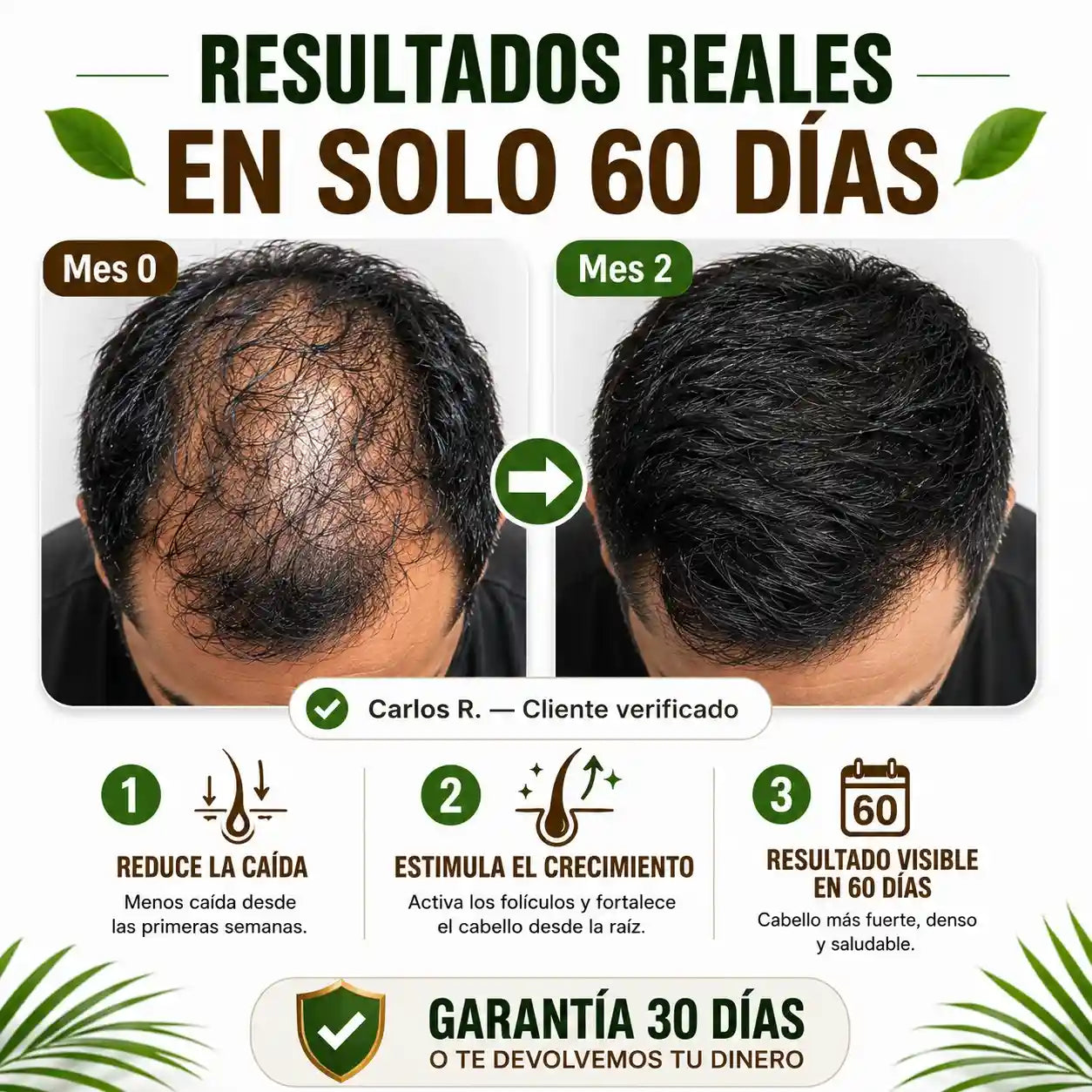 Recupera tu cabello. Recupera tu confianza