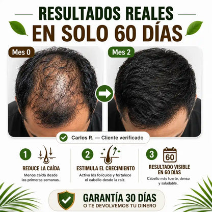 Recupera tu cabello. Recupera tu confianza