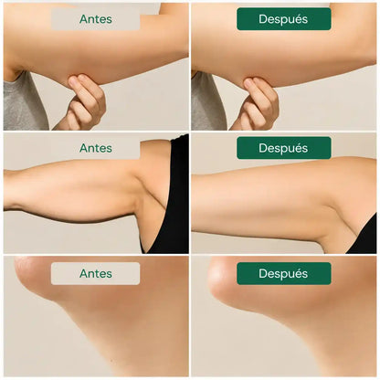 Lymphatic Support - Apoyo linfático para sentirte más ligera cada día