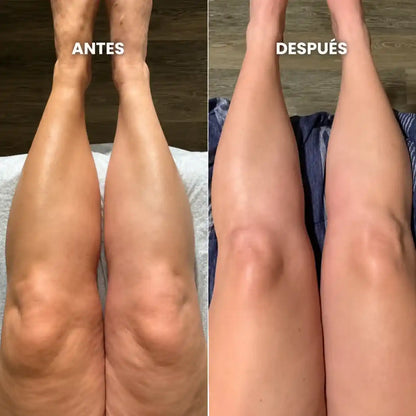Lymphatic Support - Apoyo linfático para sentirte más ligera cada día
