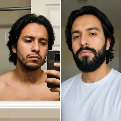 Apolo para Crecimiento de Barba Ultra Potente